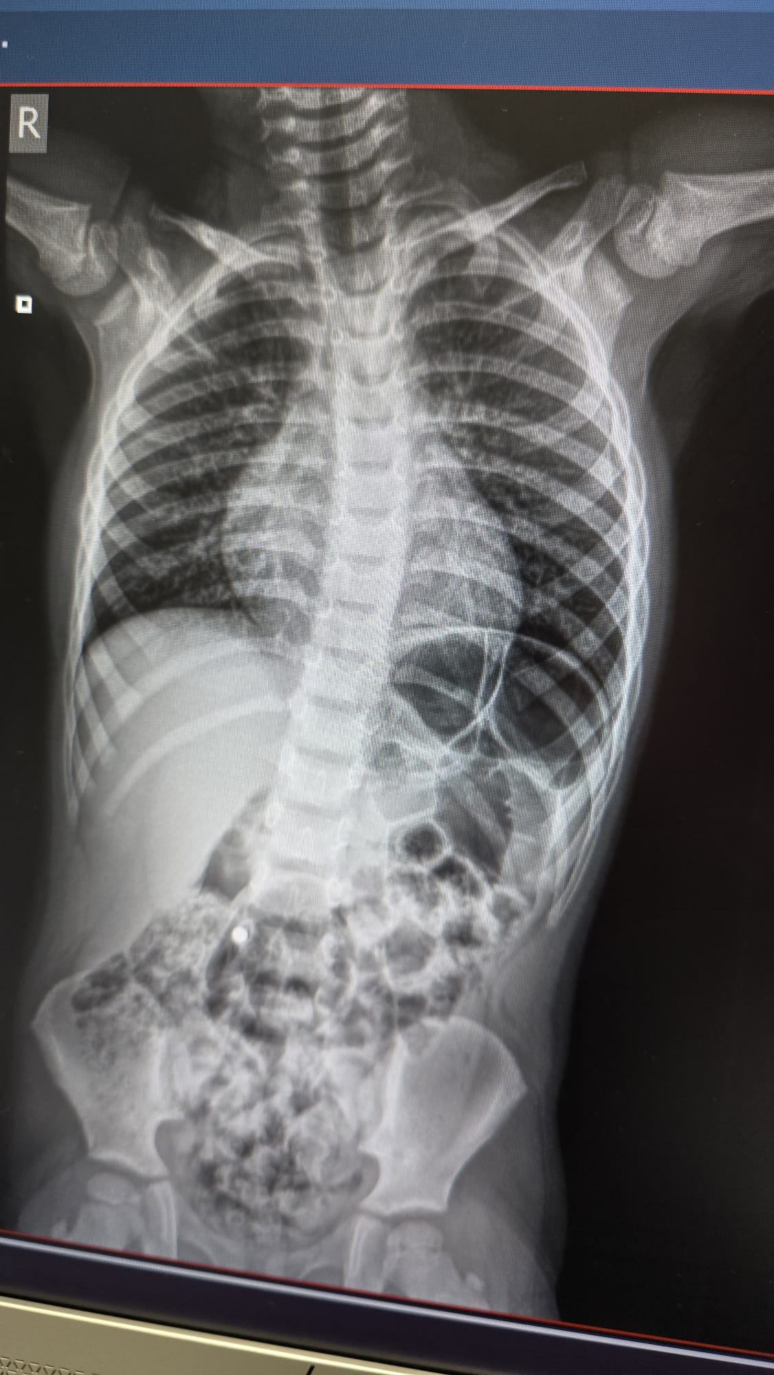 28 terviseküsimust – vastavad spetsialistid